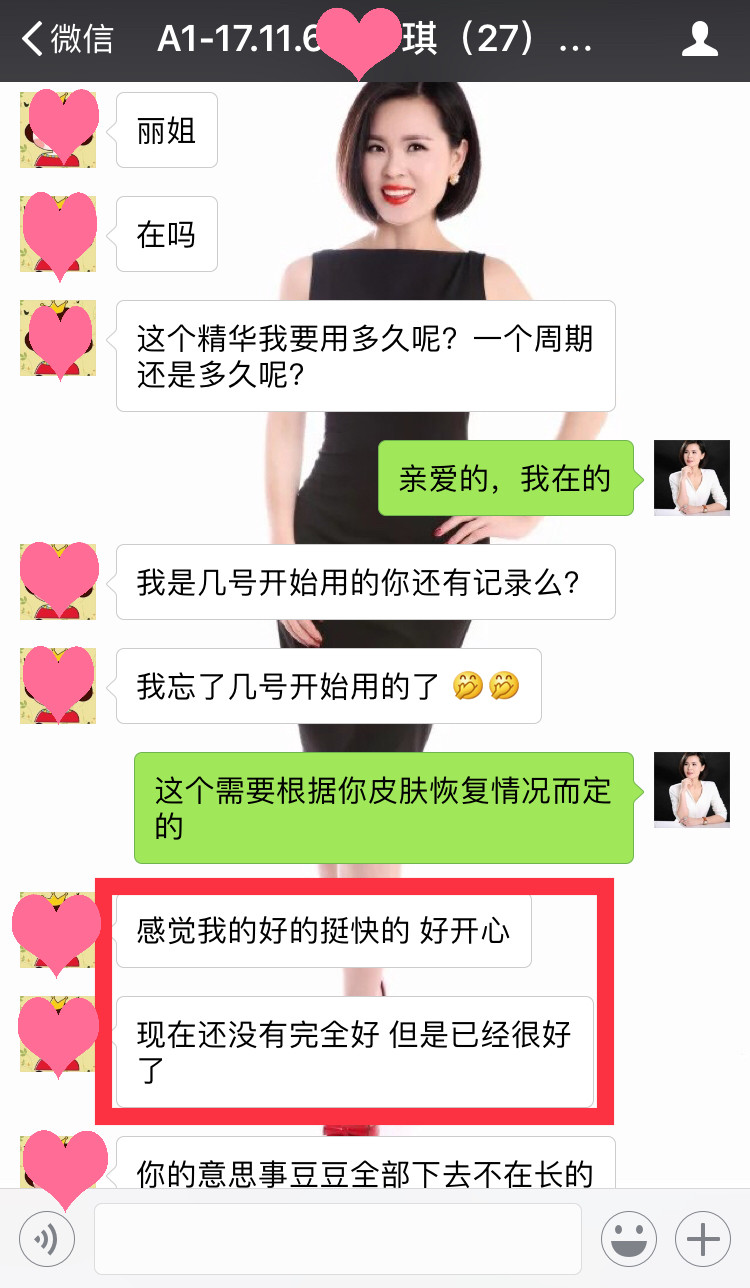 下巴長痘痘怎么解決？下巴都是痘痘怎么辦，不要盲目選擇,快看這里