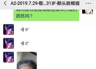 額頭上的閉合性粉刺怎么去除？分享下舞蹈老師敬敬的經驗