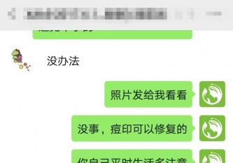 丘疹型痘痘怎么辦？看小付如何成功蛻變