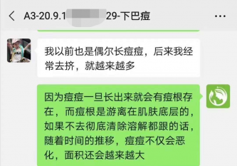 下巴痘痘反反復復是什么原因？點進來看看